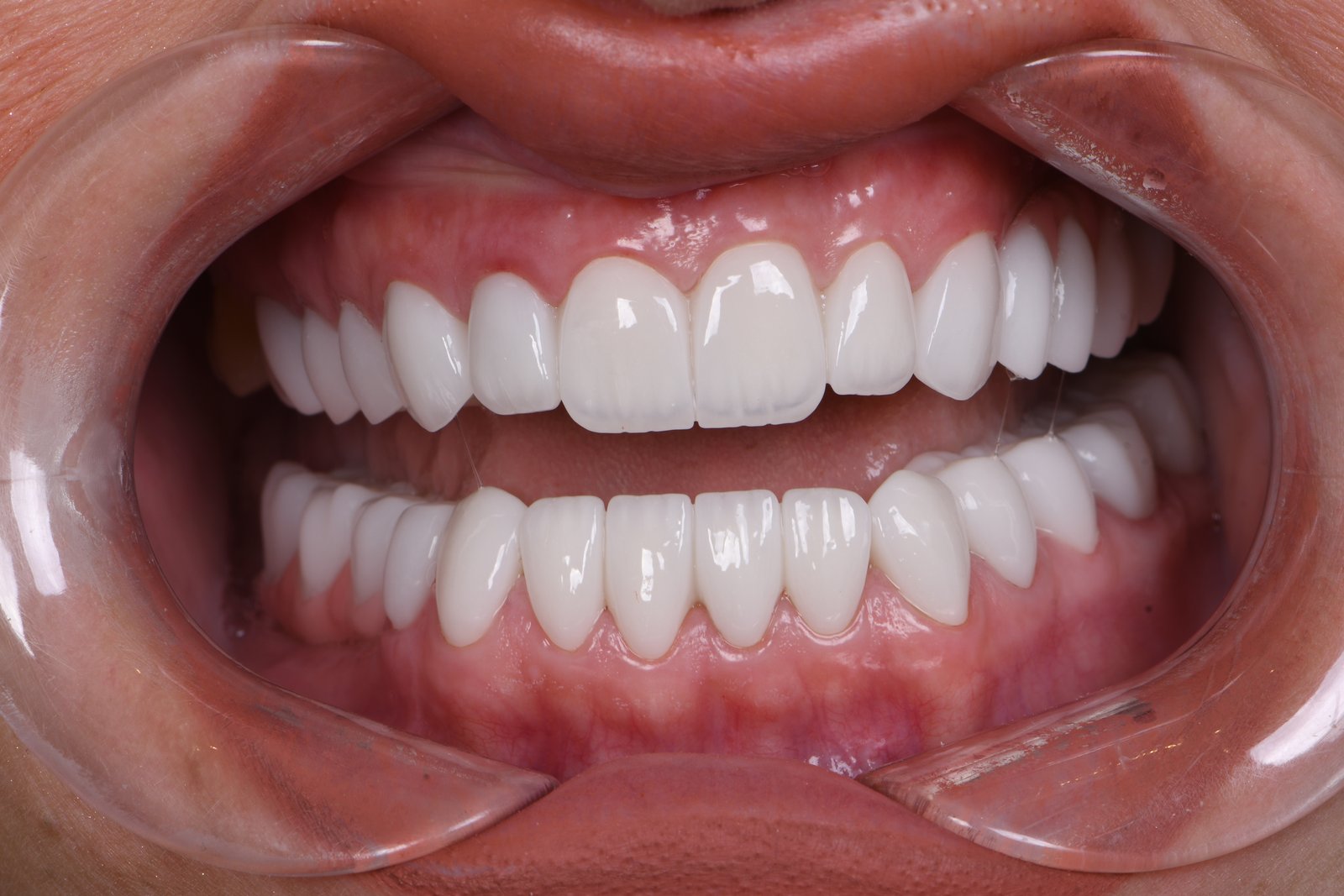 After treatment — case 1
