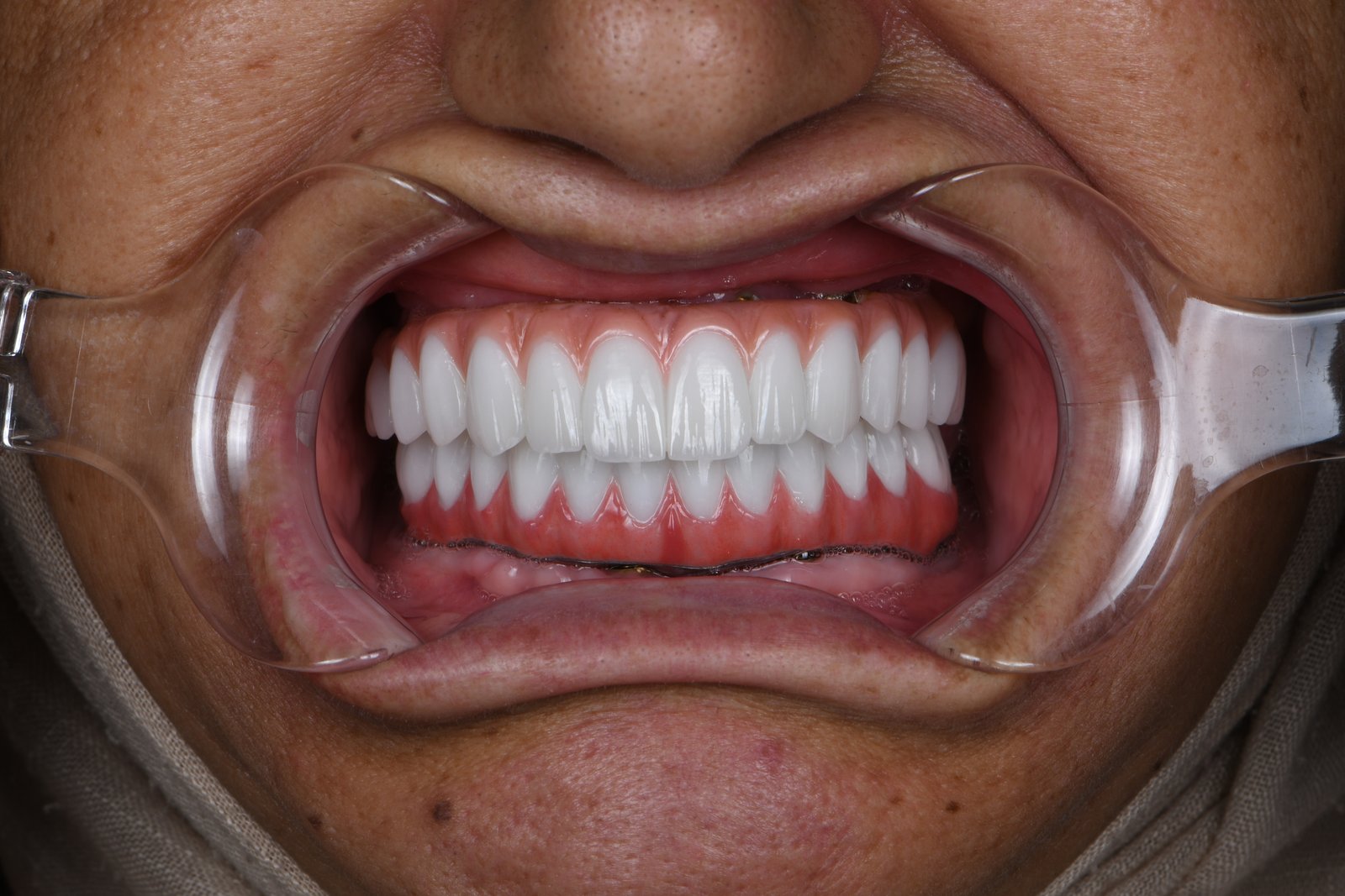After treatment — case 2