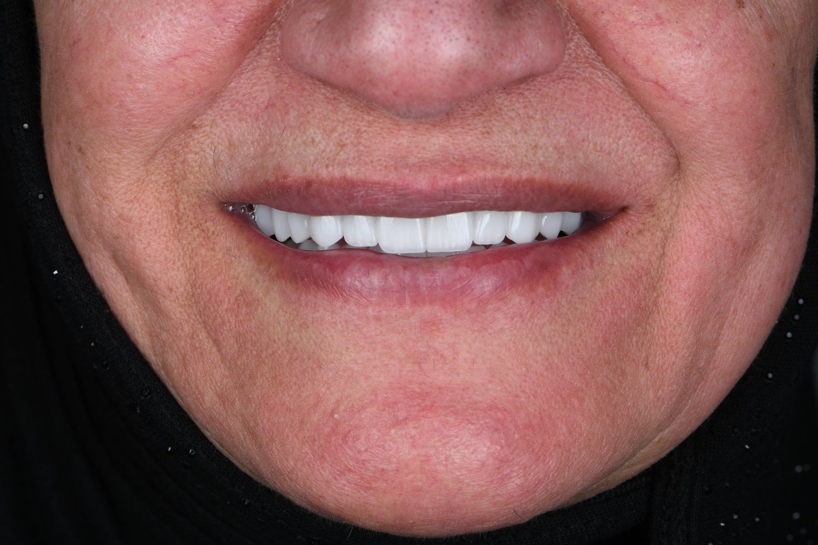 After treatment — case 3