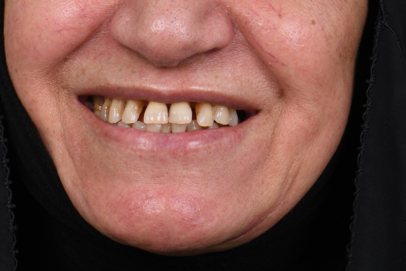 Before treatment — case 3