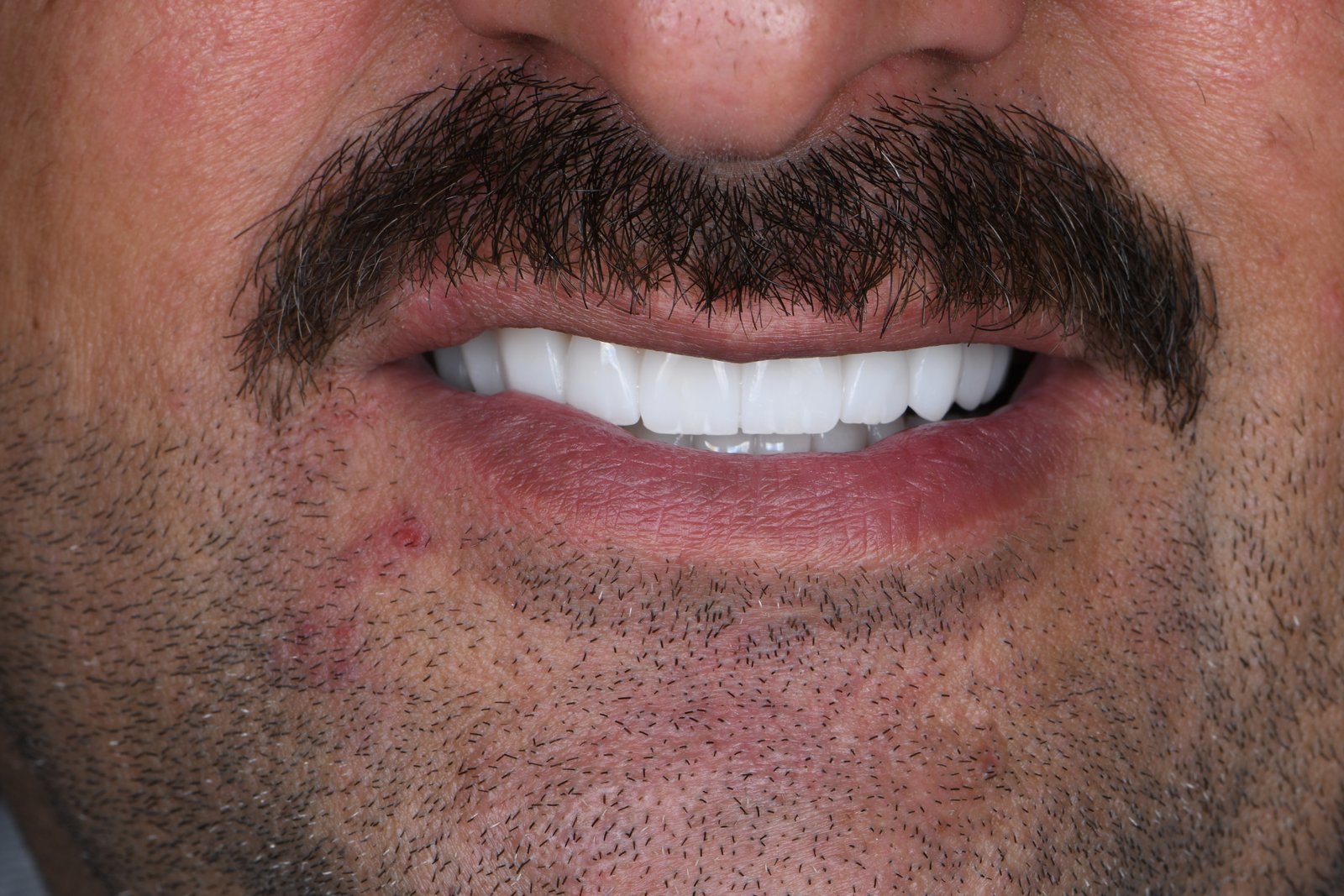 After treatment — case 5