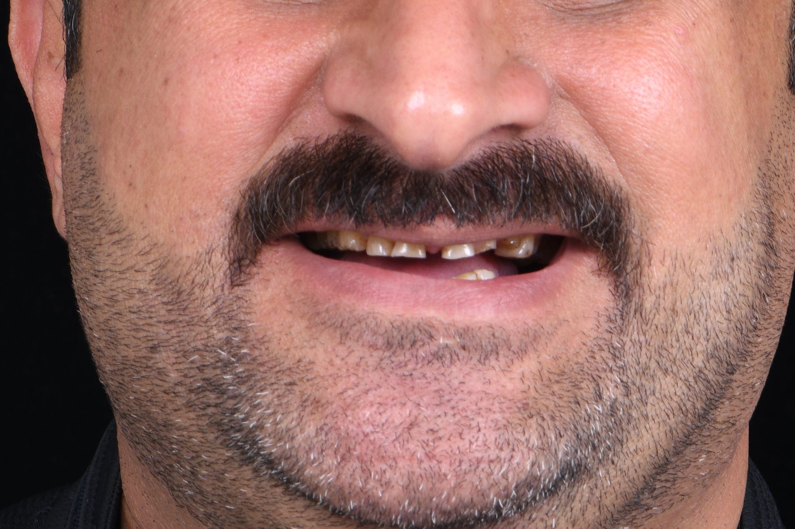 Before treatment — case 5