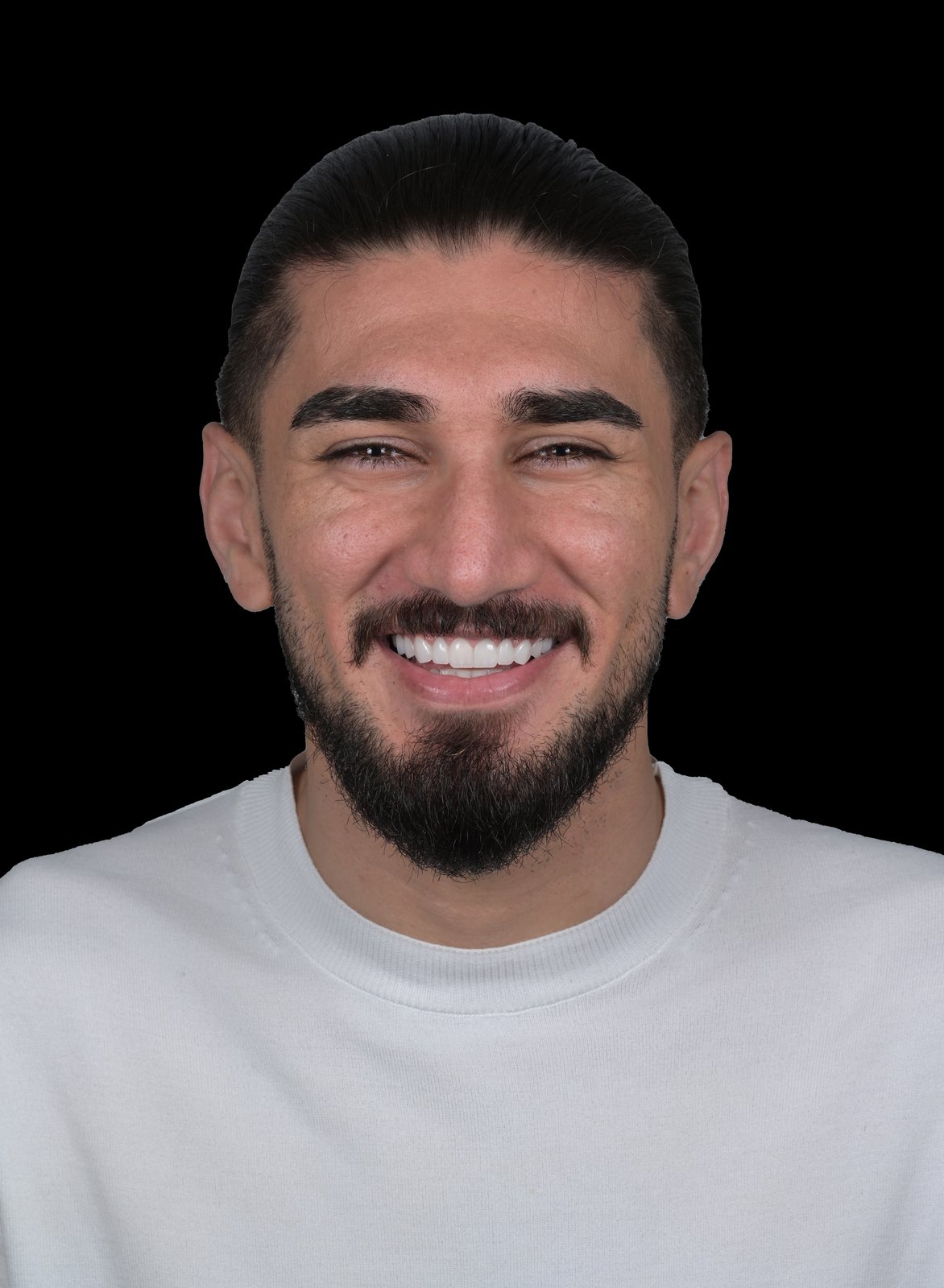 After treatment — case 1