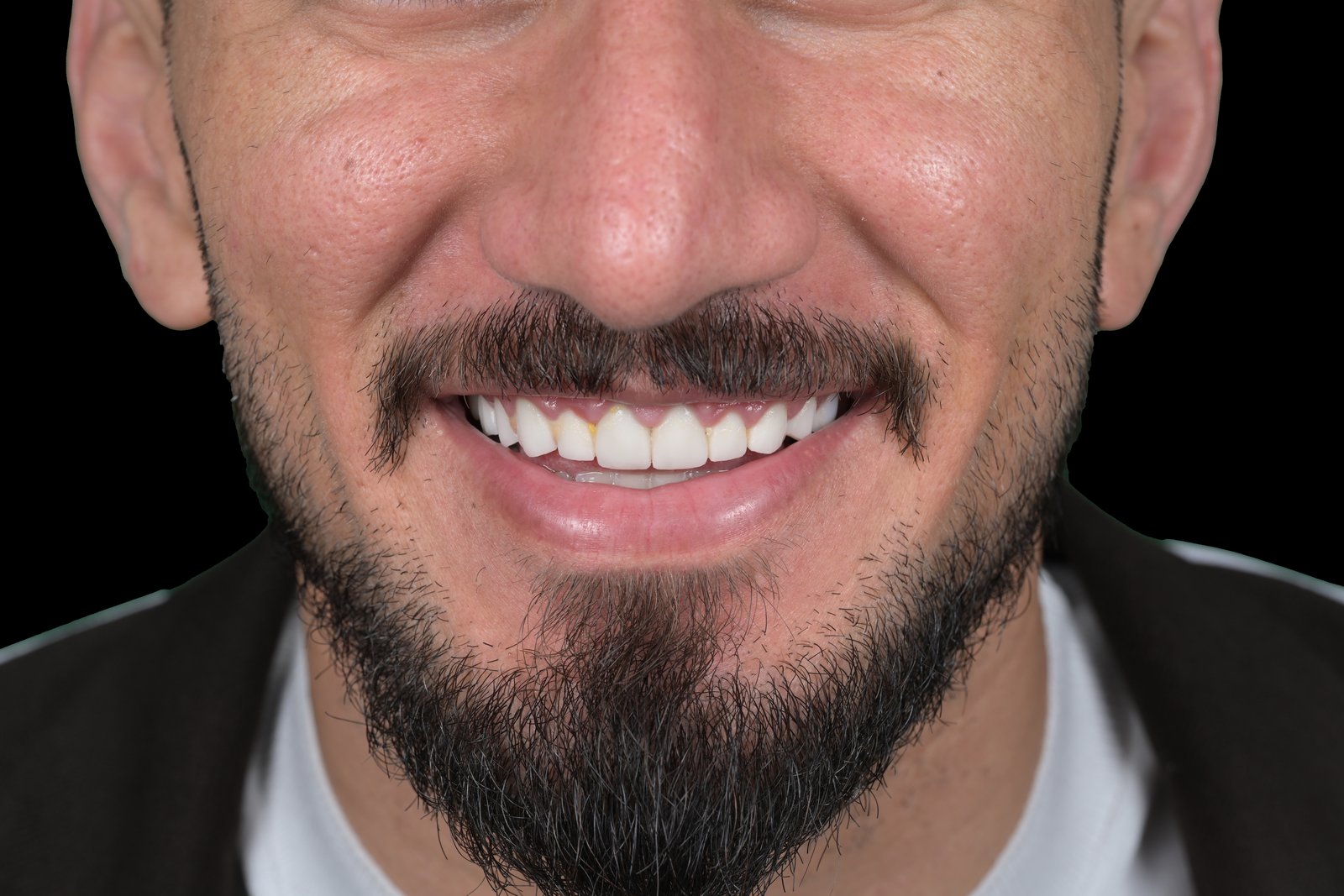 Before treatment — case 1