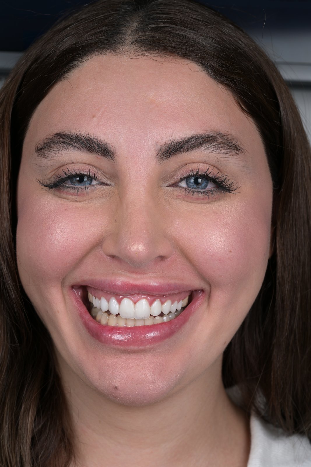 Before treatment — case 2