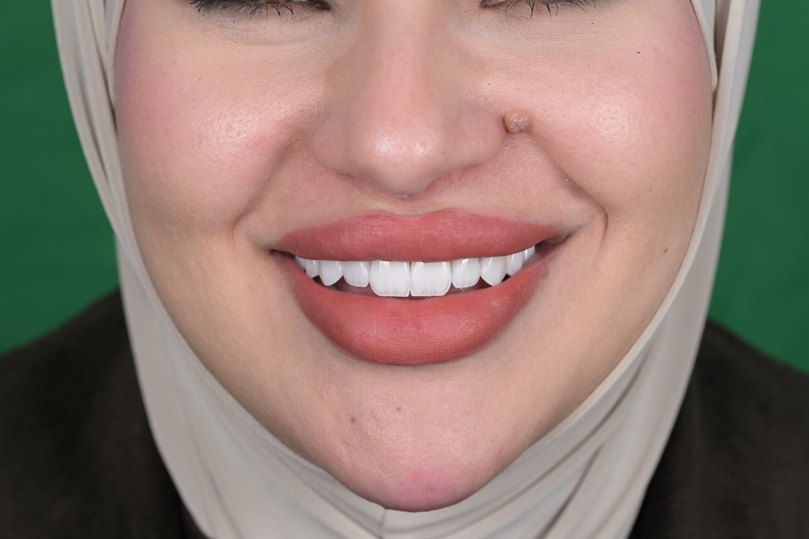 After treatment — case 3