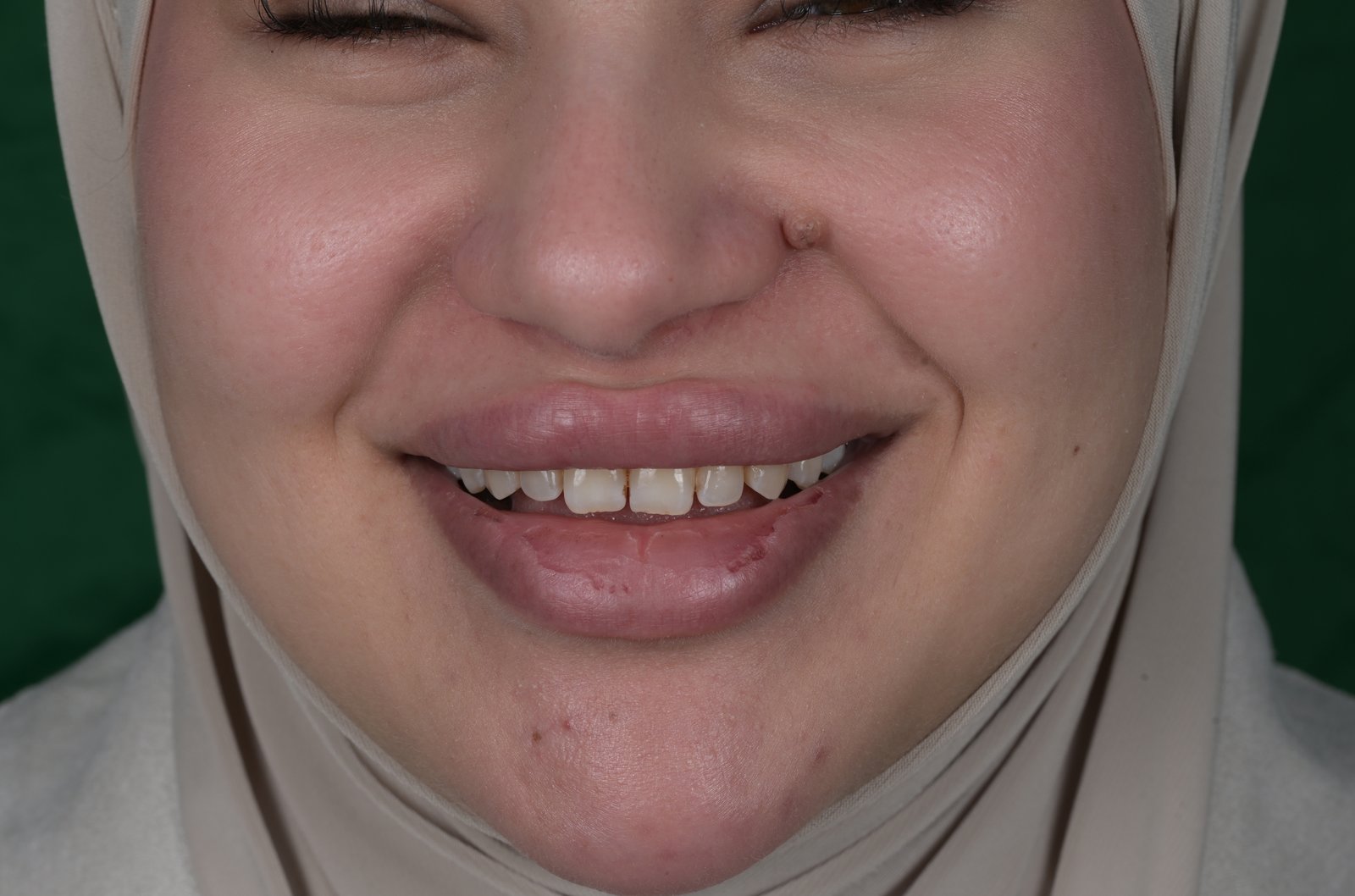 Before treatment — case 3
