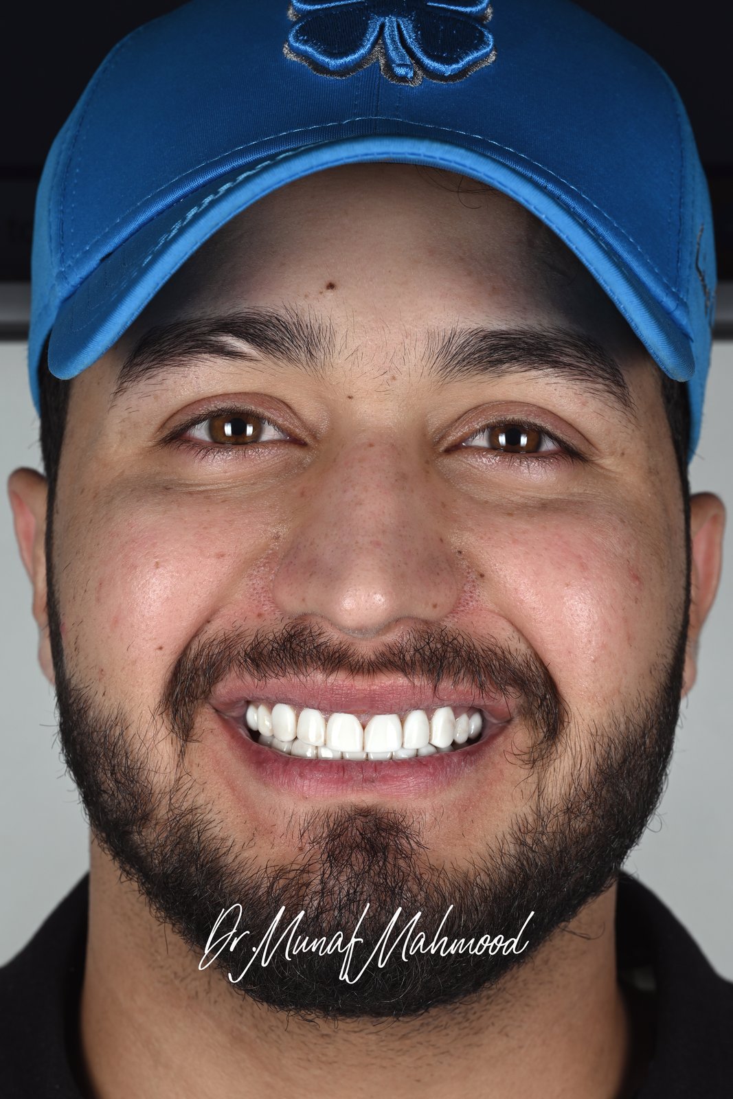 Before treatment — case 4