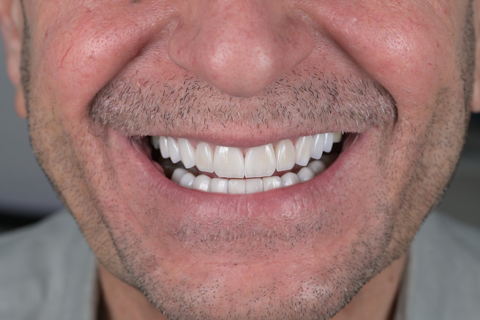 After treatment — case 7