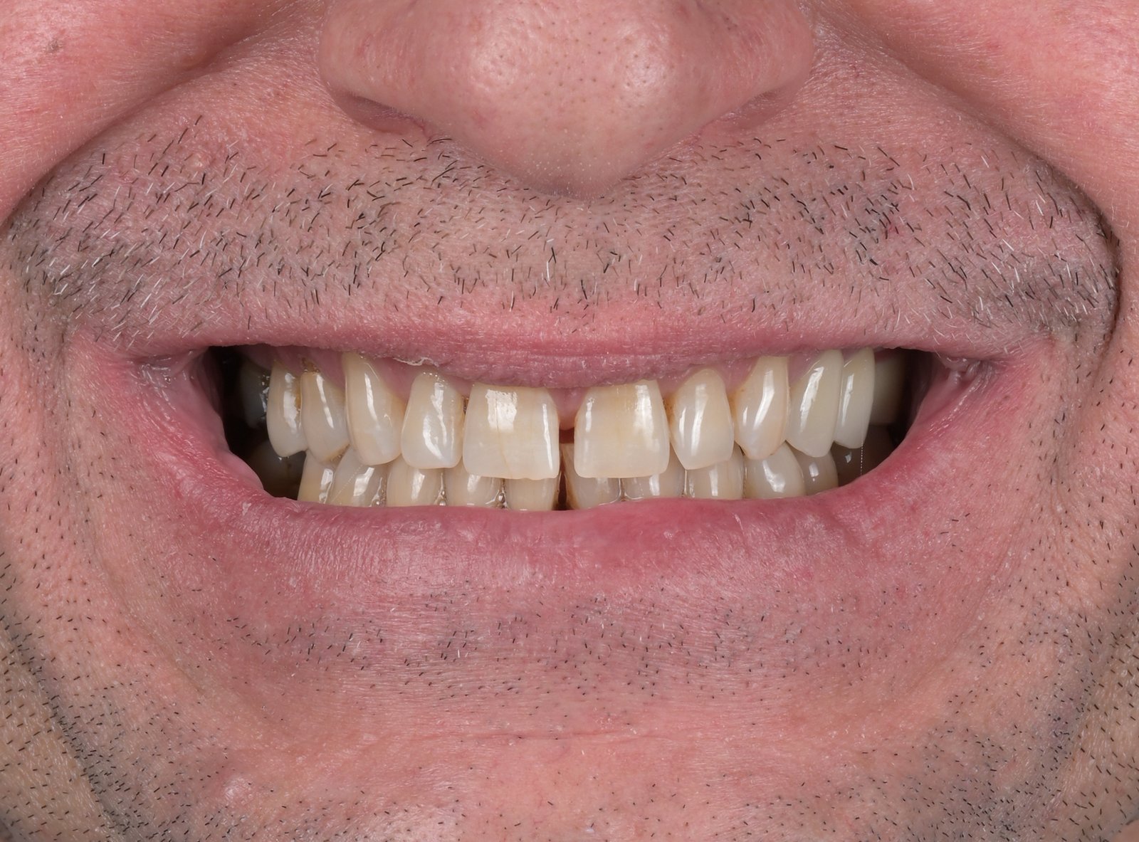 Before treatment — case 7