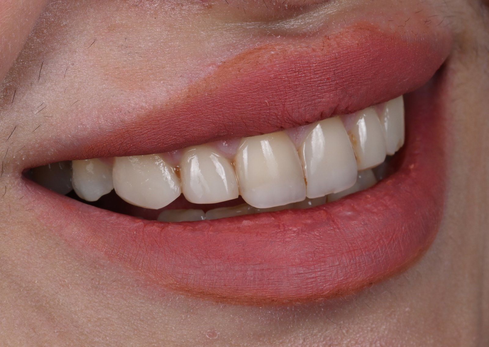 Before treatment — case 8