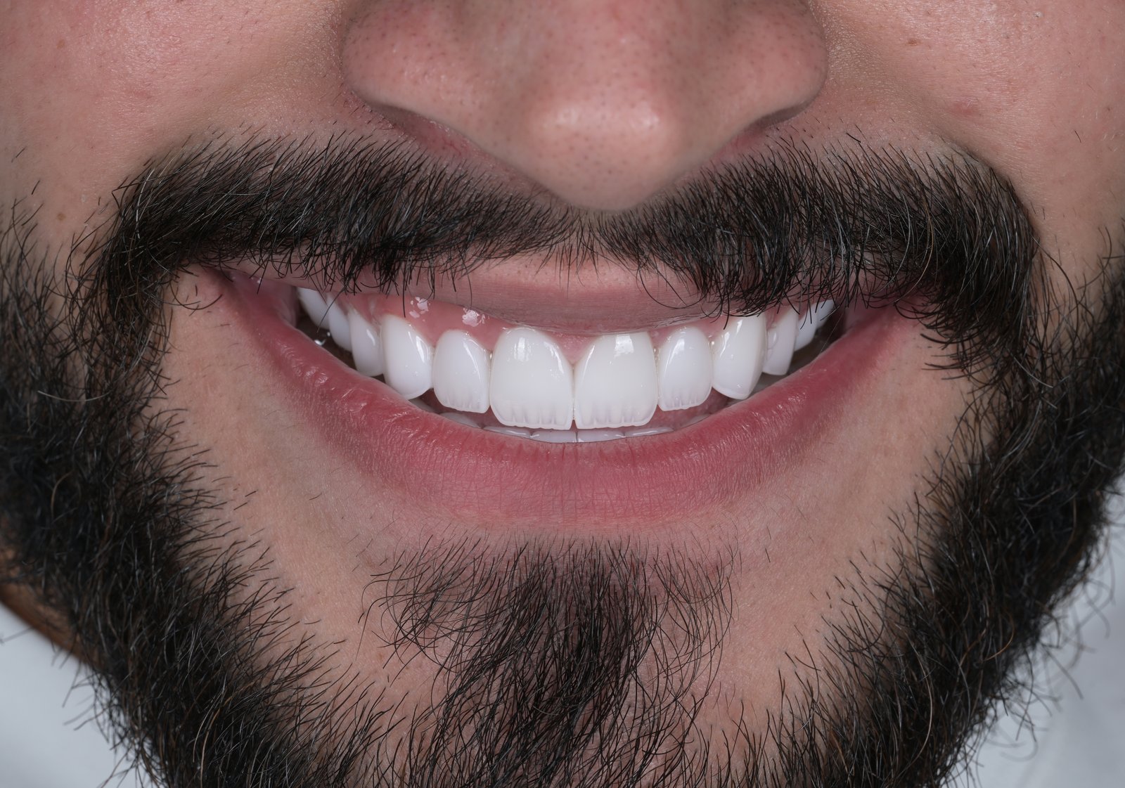 After treatment — case 9
