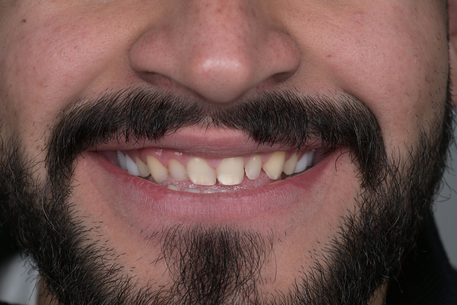 Before treatment — case 9