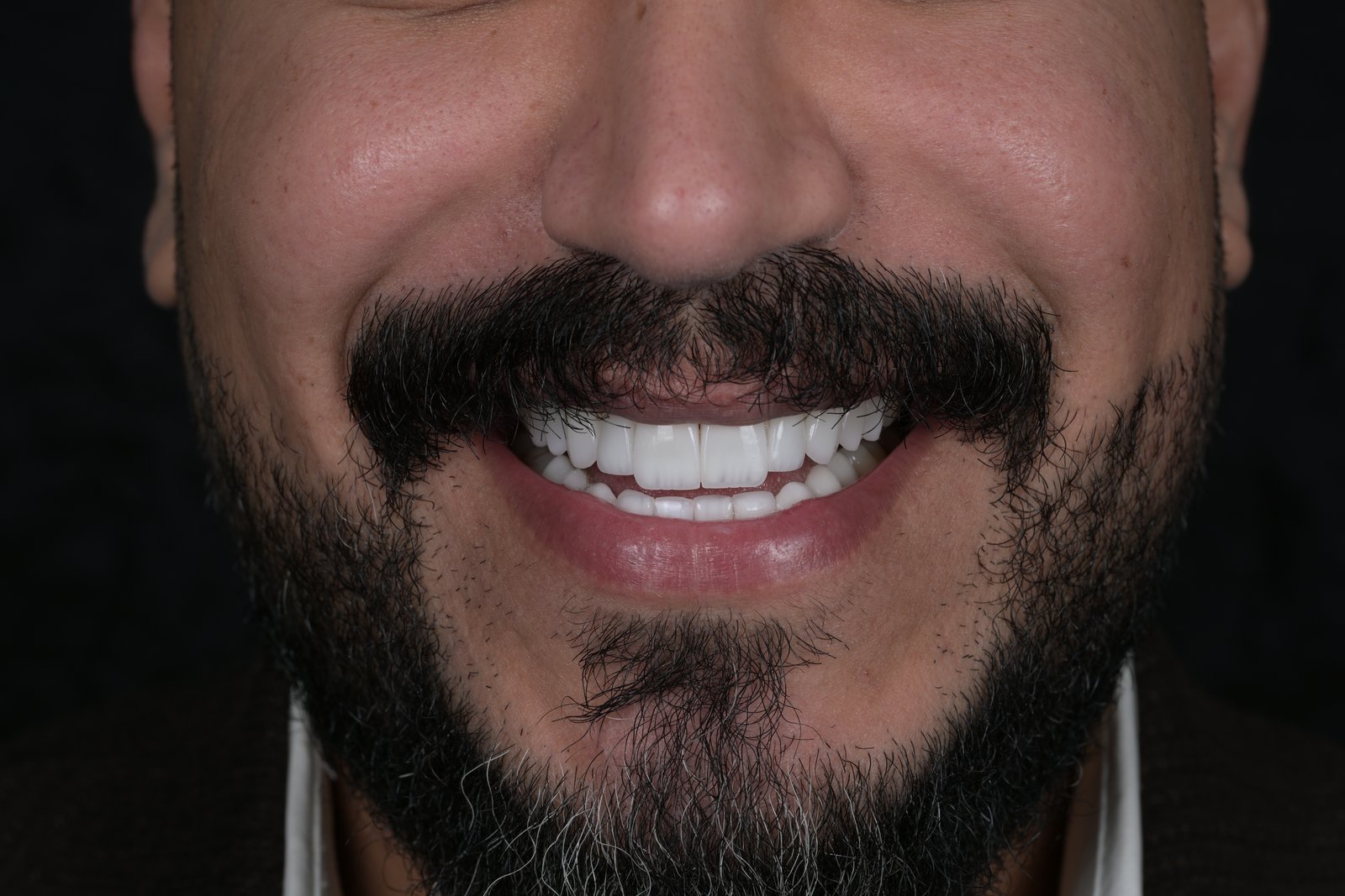 After treatment — case 10