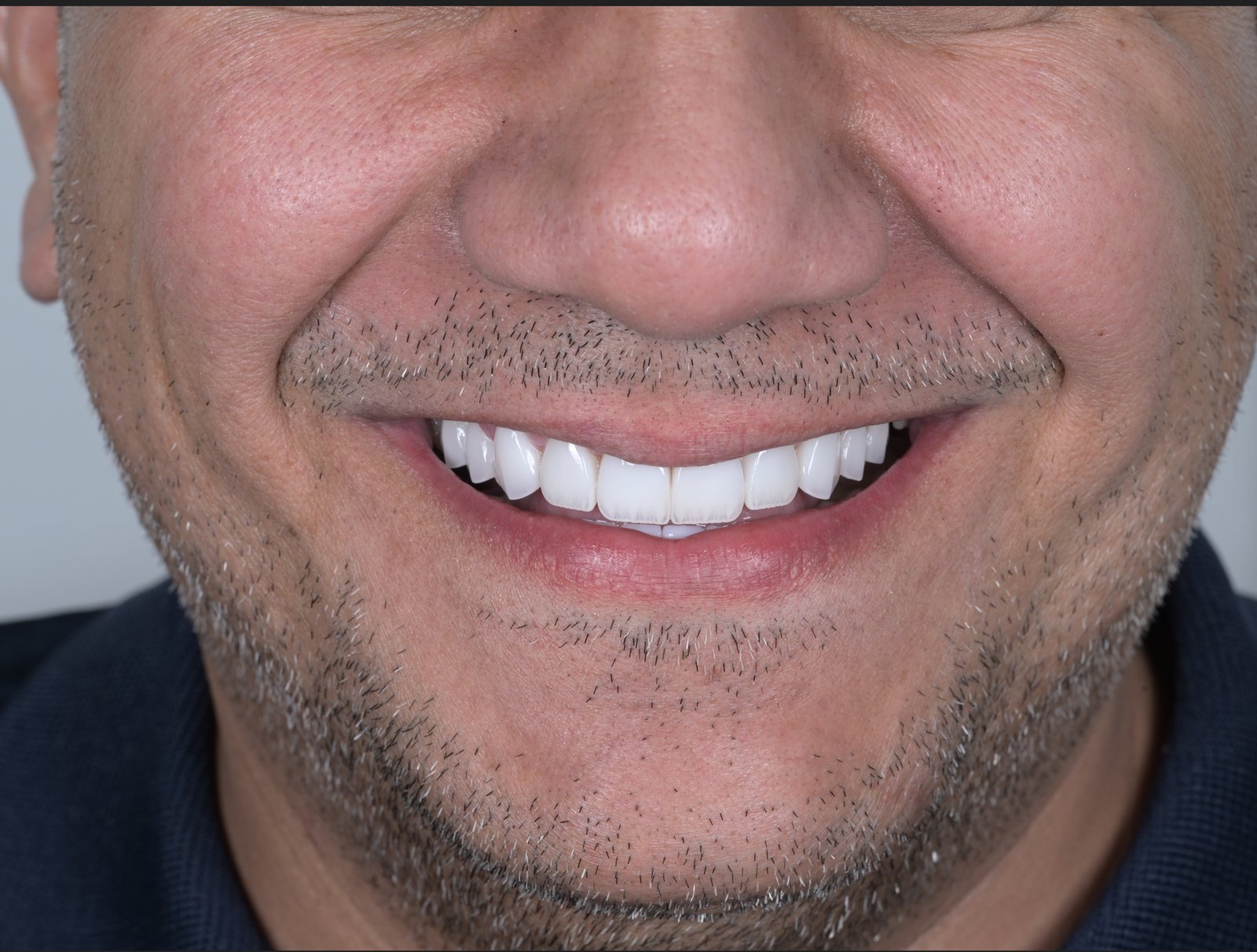 After treatment — case 11
