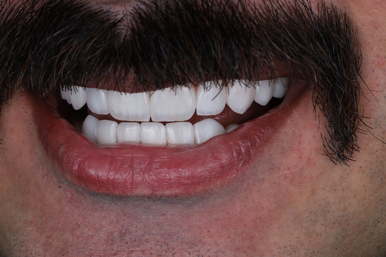 After treatment