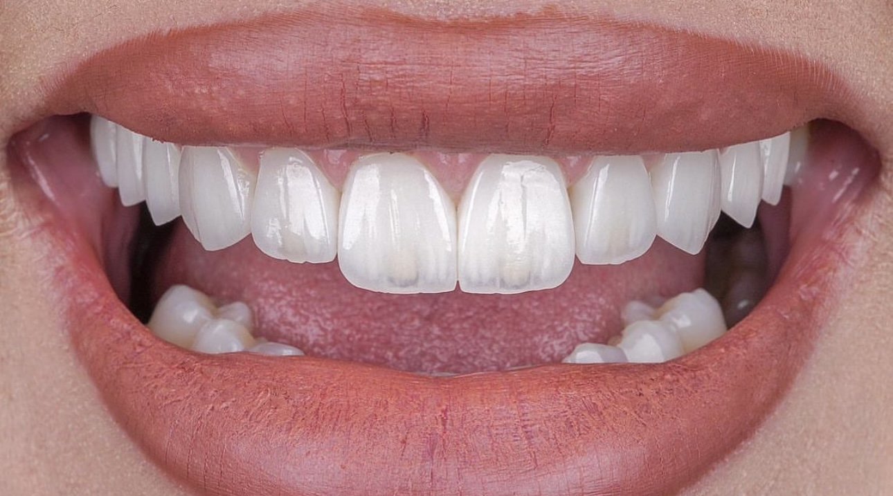 After treatment