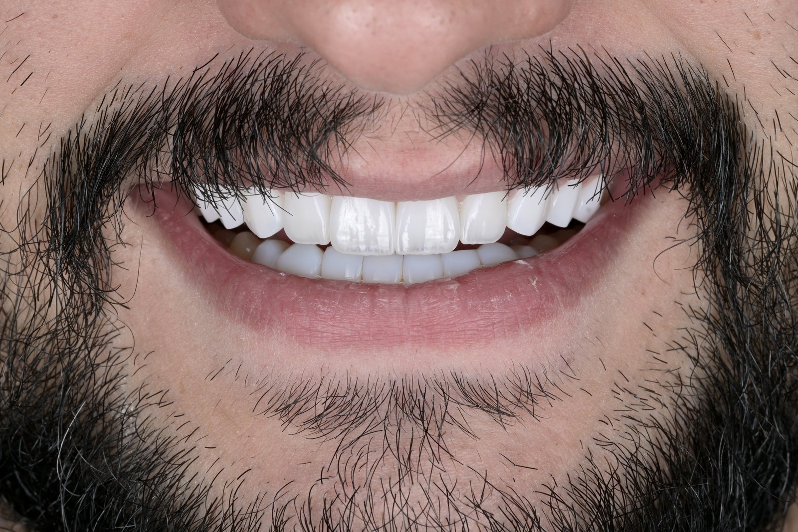 After treatment