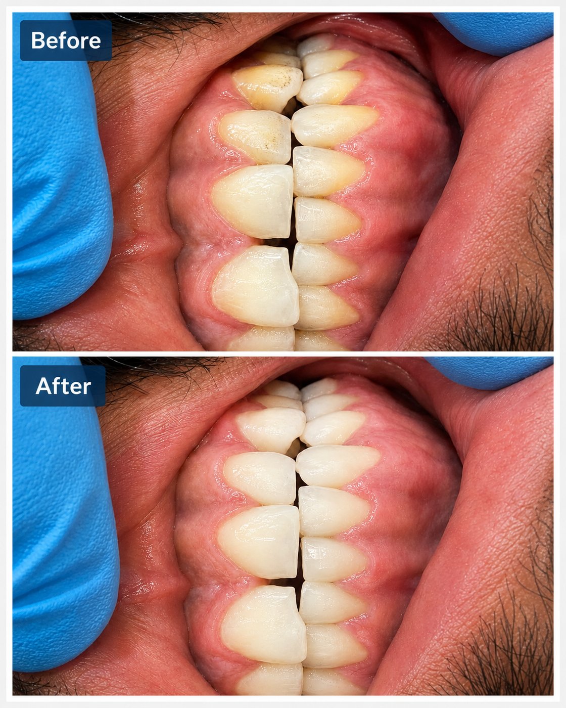 Clinical case — Dr. Yaseen Salah