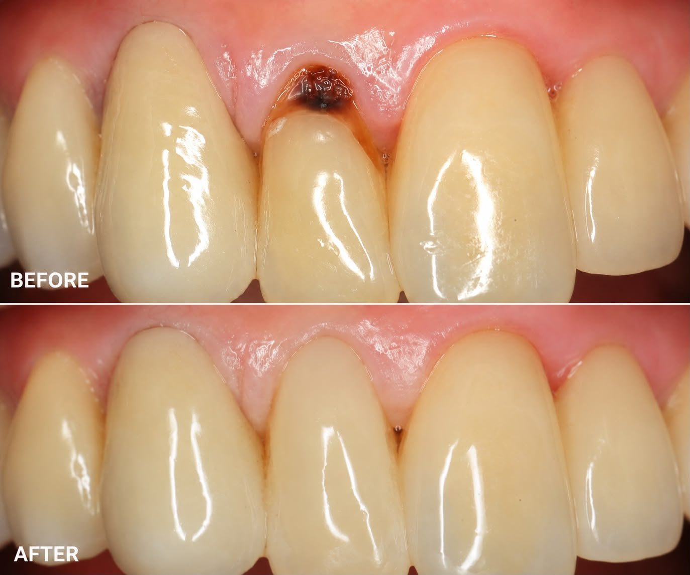 Clinical case — Dr. Yaseen Salah