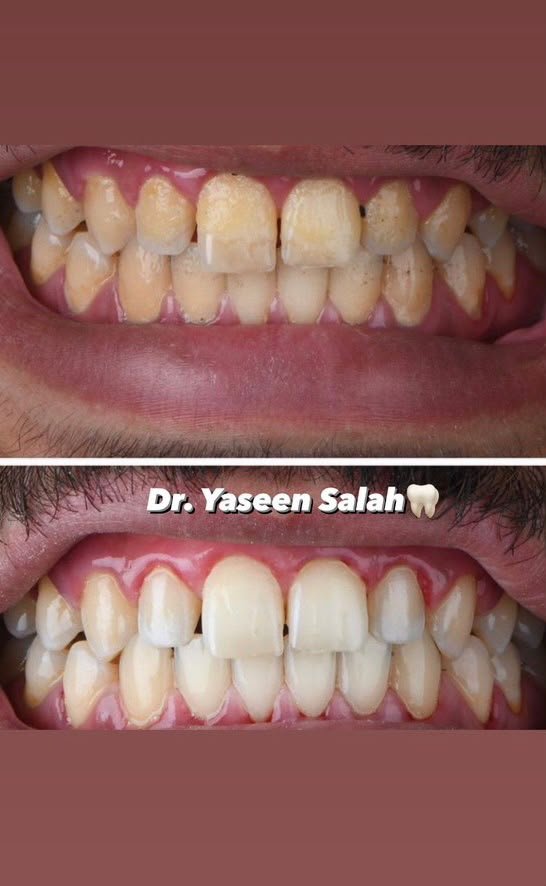 Clinical case — Dr. Yaseen Salah