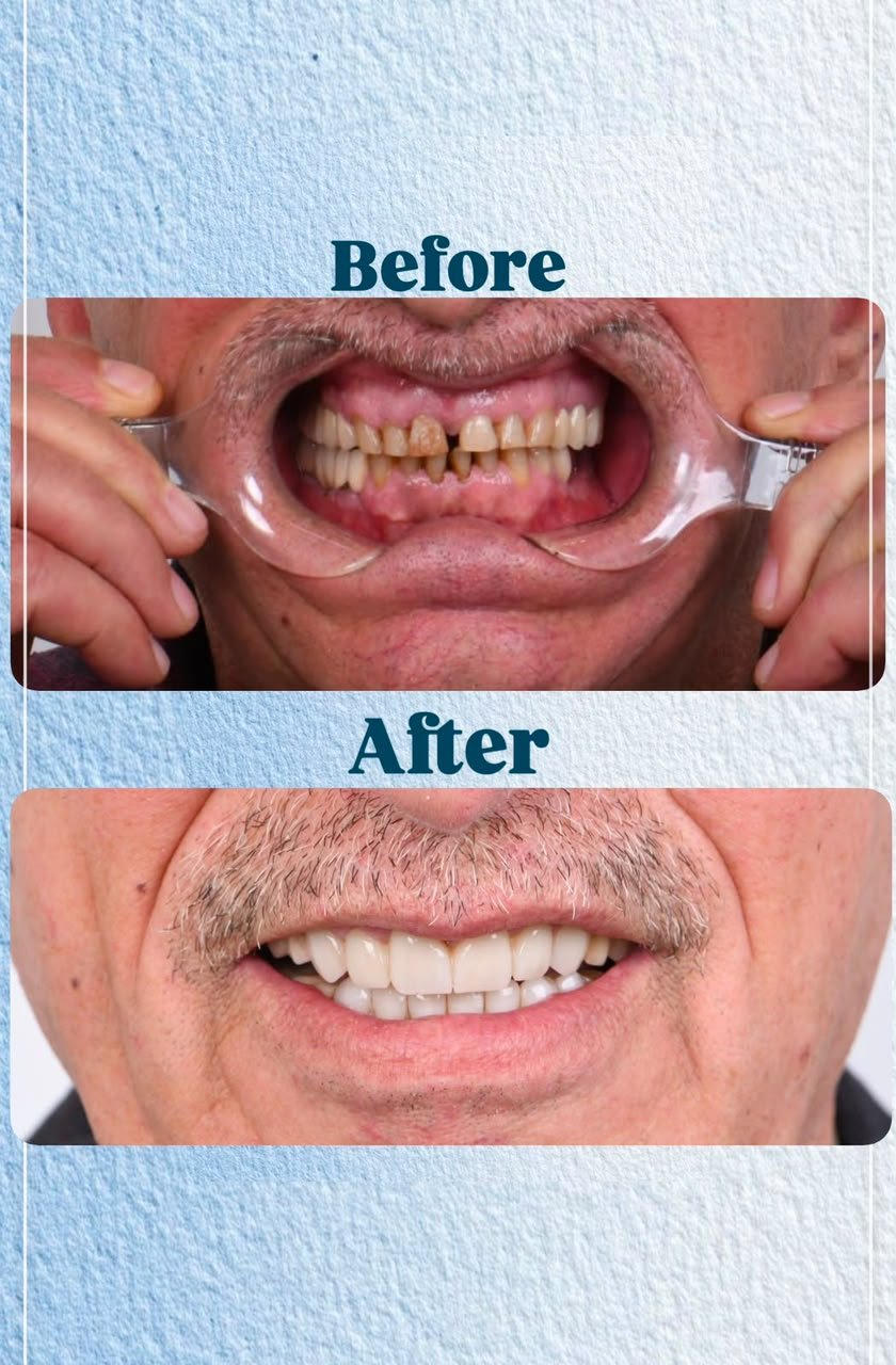 Clinical case — Dr. Yaseen Salah