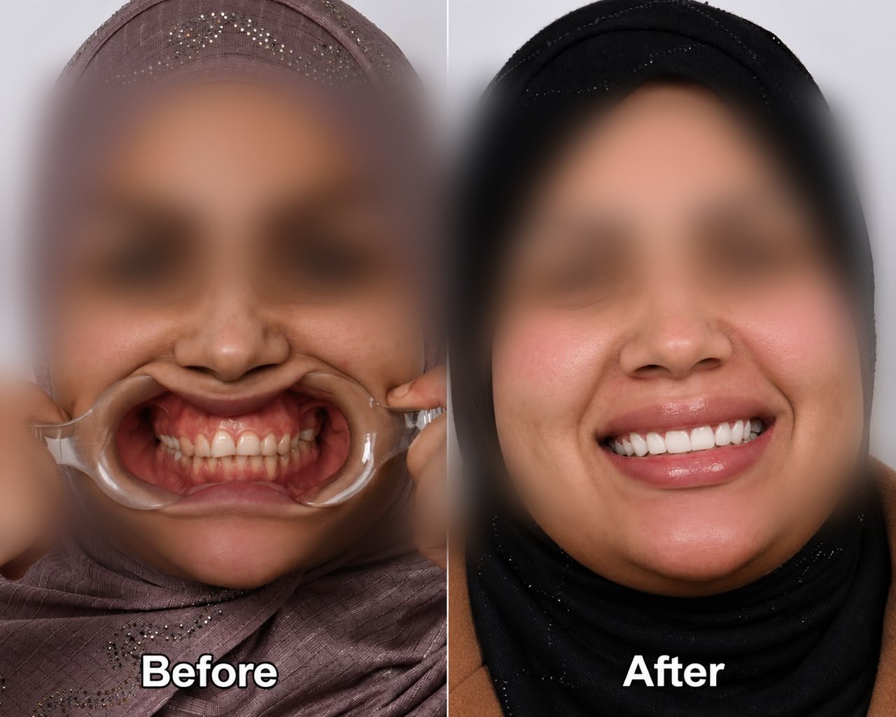 Clinical case — Dr. Yaseen Salah