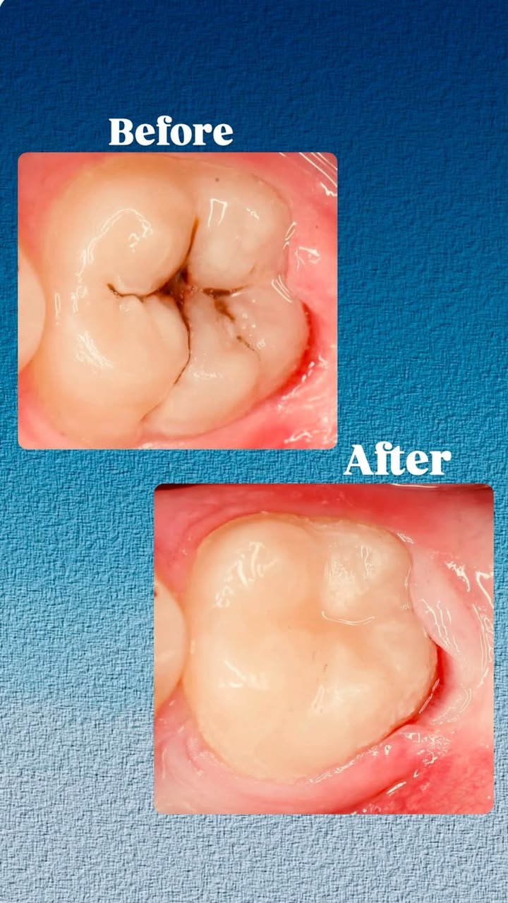 Clinical case — Dr. Yaseen Salah