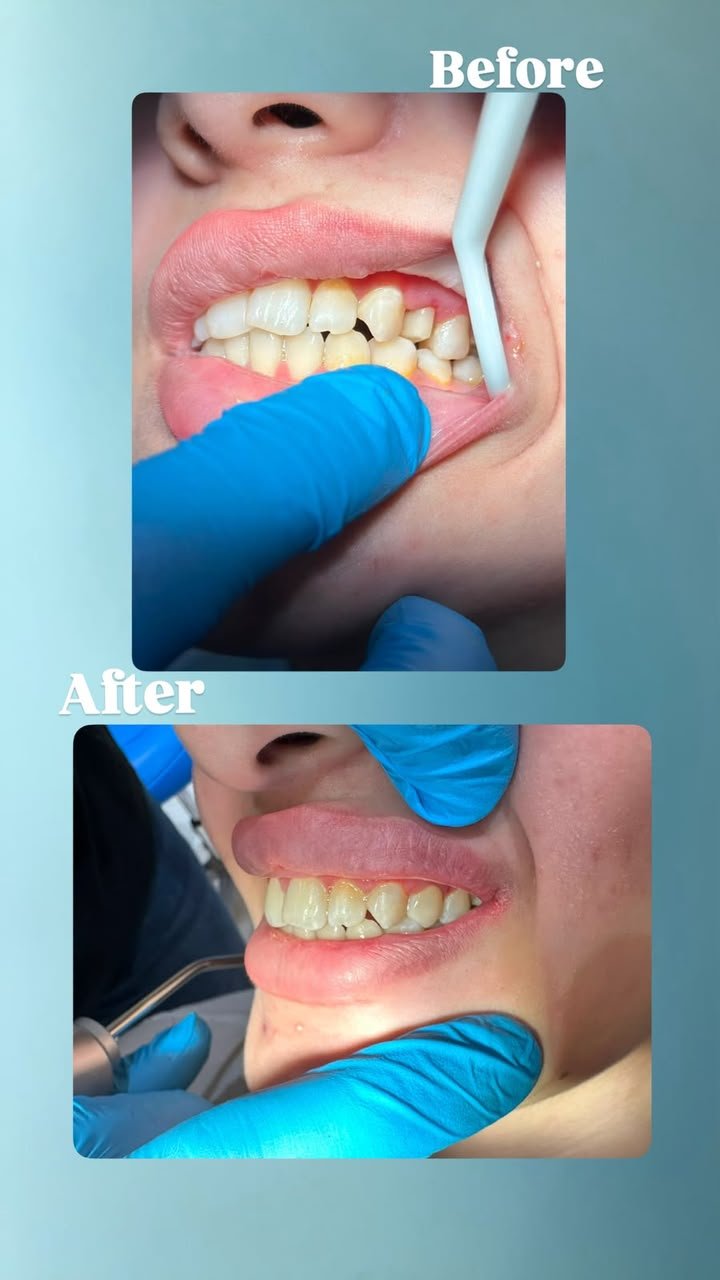 Clinical case — Dr. Yaseen Salah