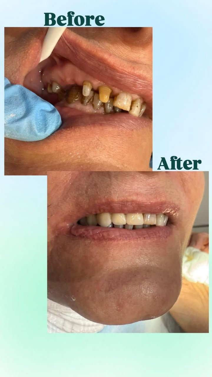 Clinical case — Dr. Yaseen Salah