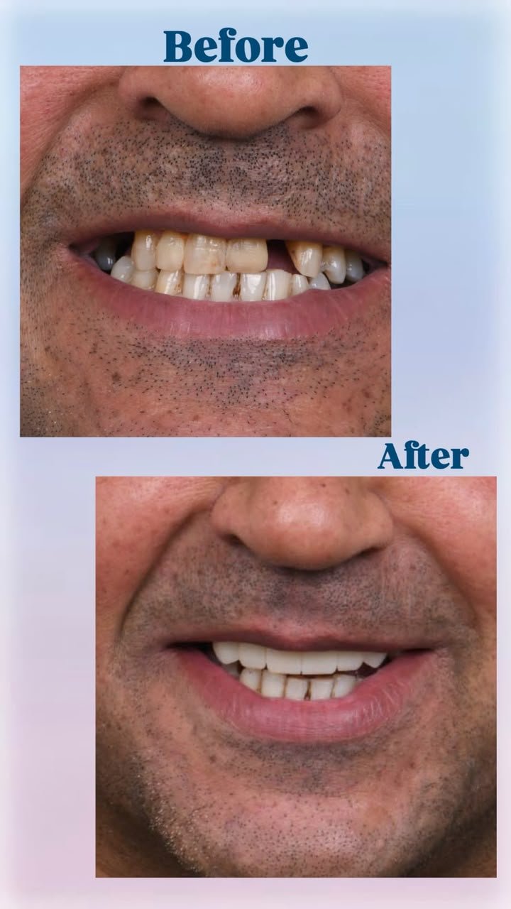 Clinical case — Dr. Yaseen Salah