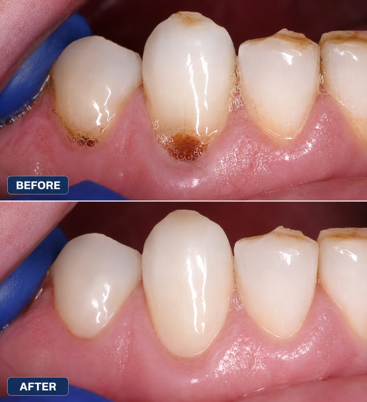 Clinical case — Dr. Yaseen Salah