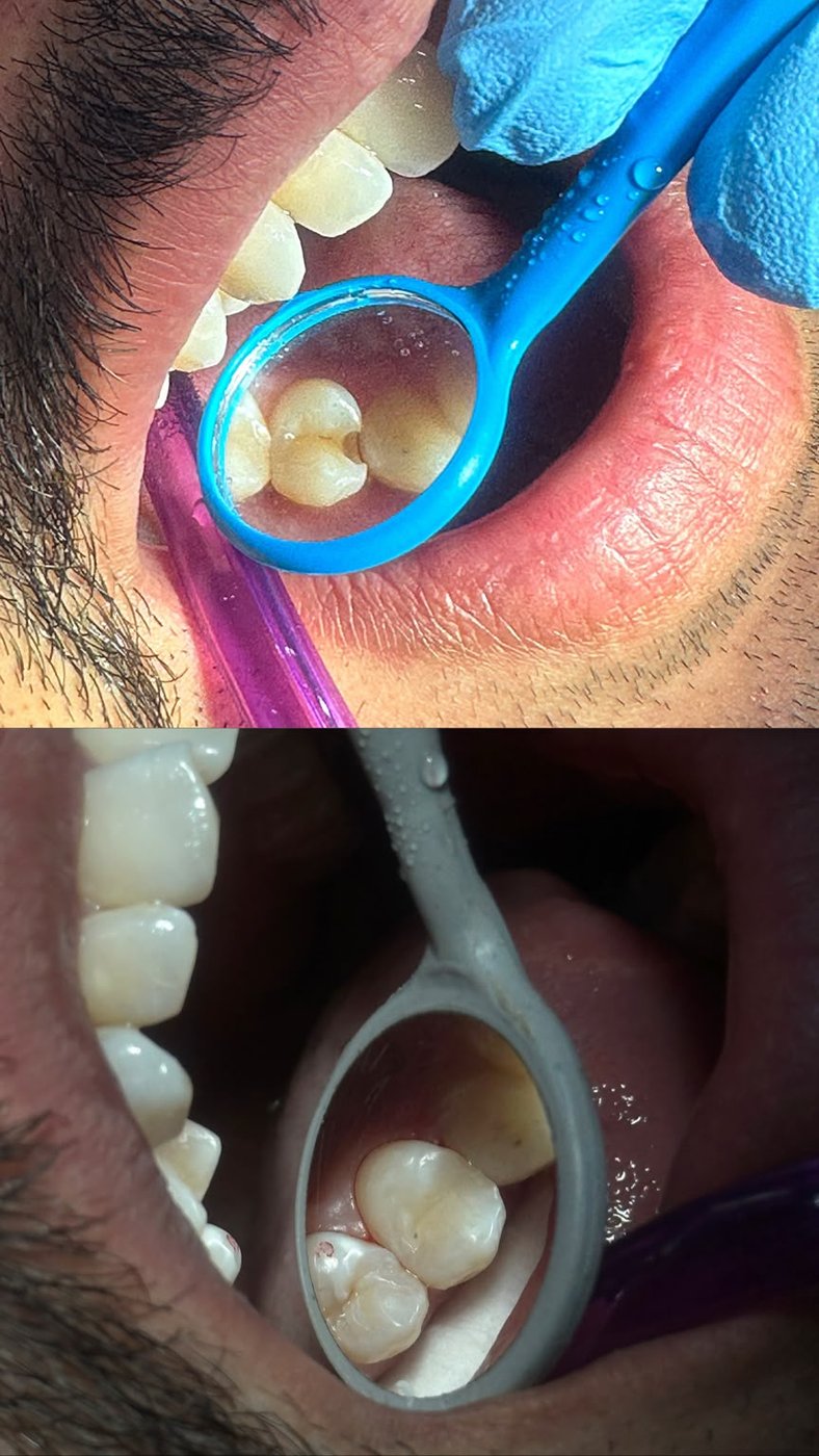 Clinical case — Dr. Yaseen Salah