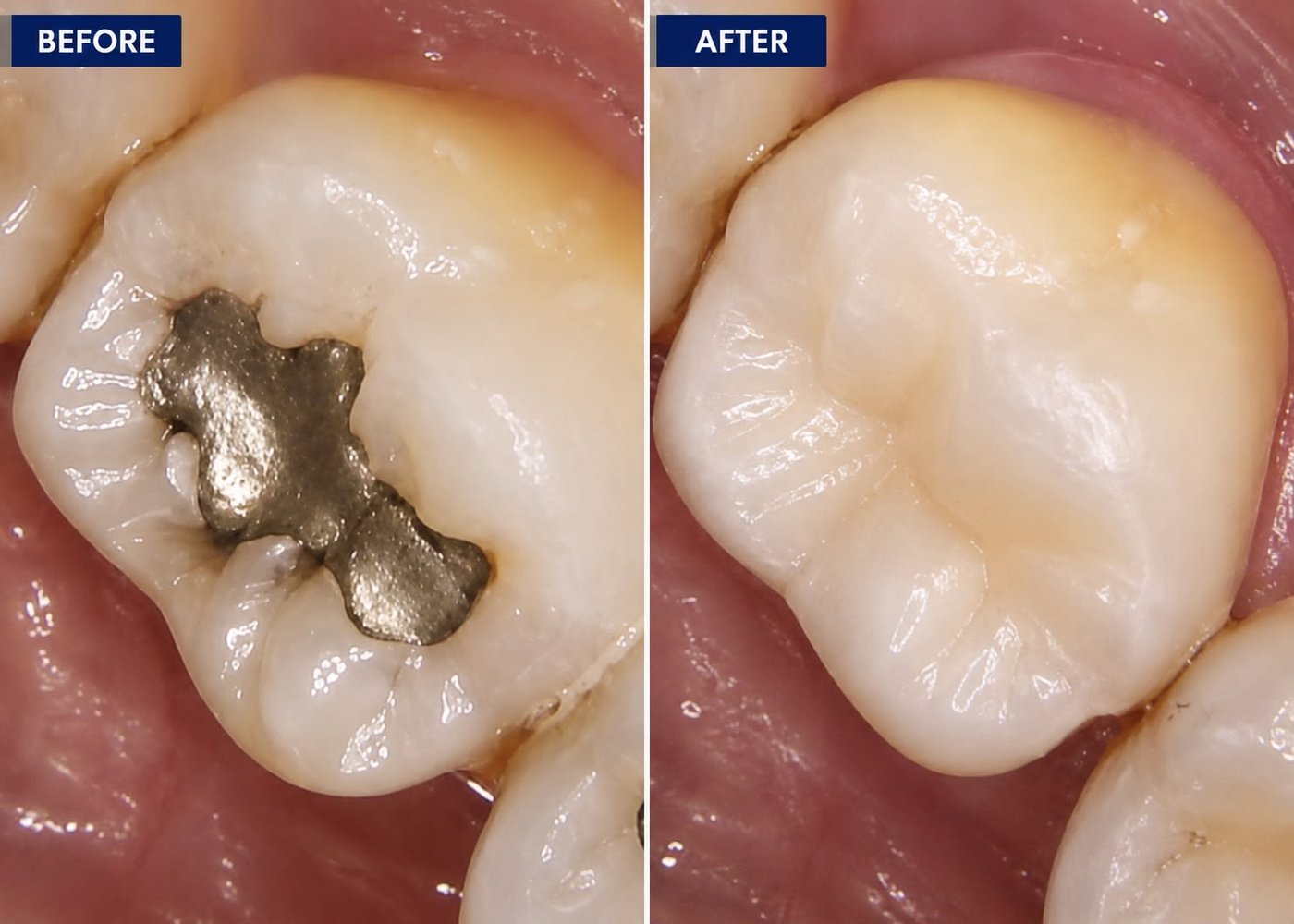 Clinical case — Dr. Yaseen Salah