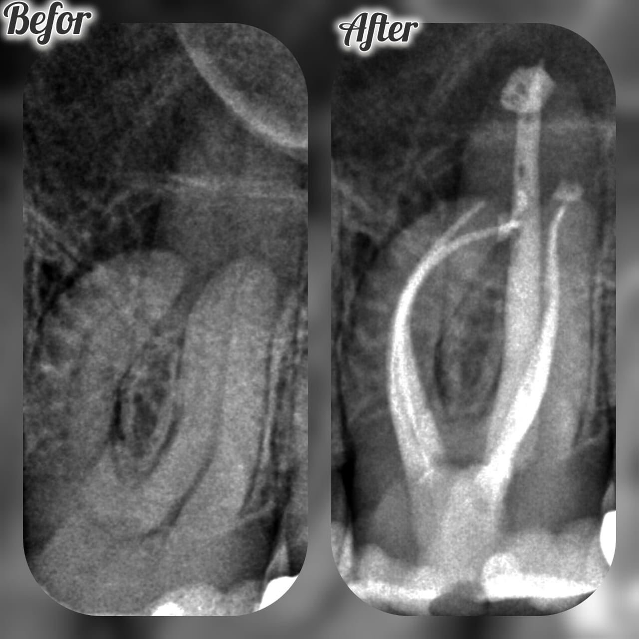 Clinical case — Dr. Yaseen Salah