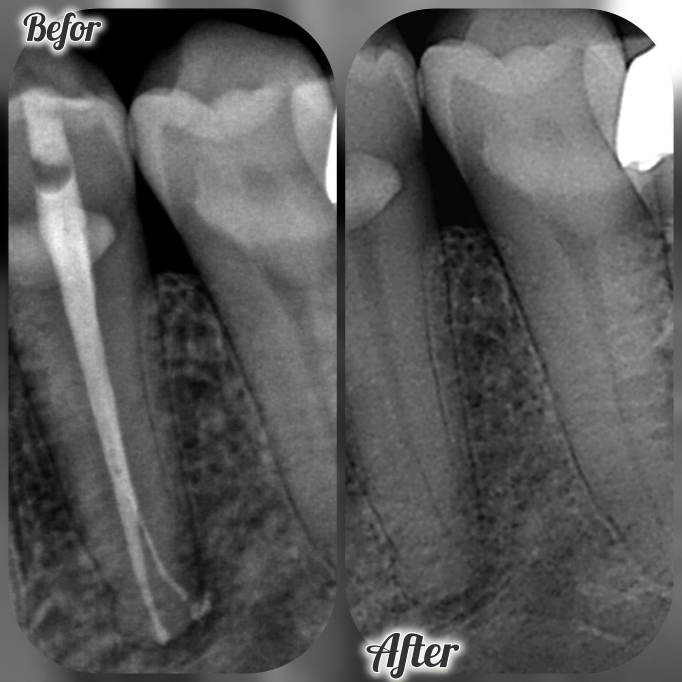 Clinical case — Dr. Yaseen Salah