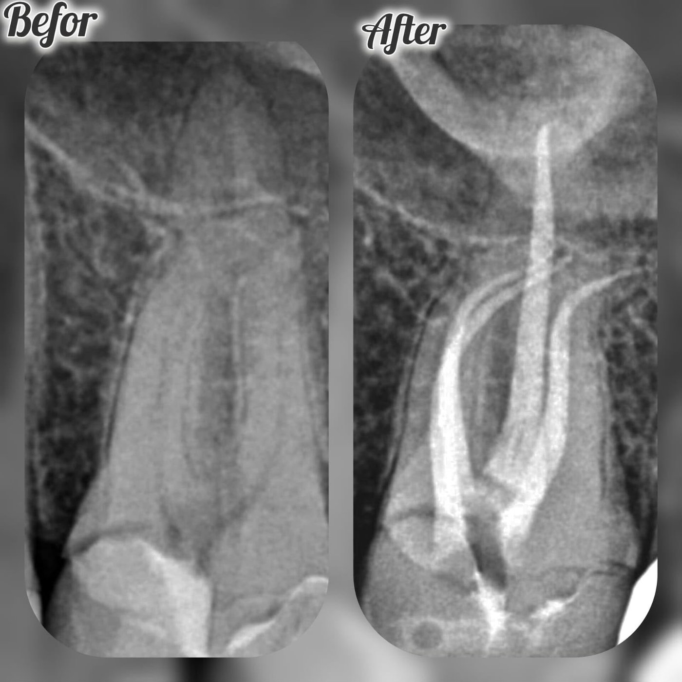 Clinical case — Dr. Yaseen Salah