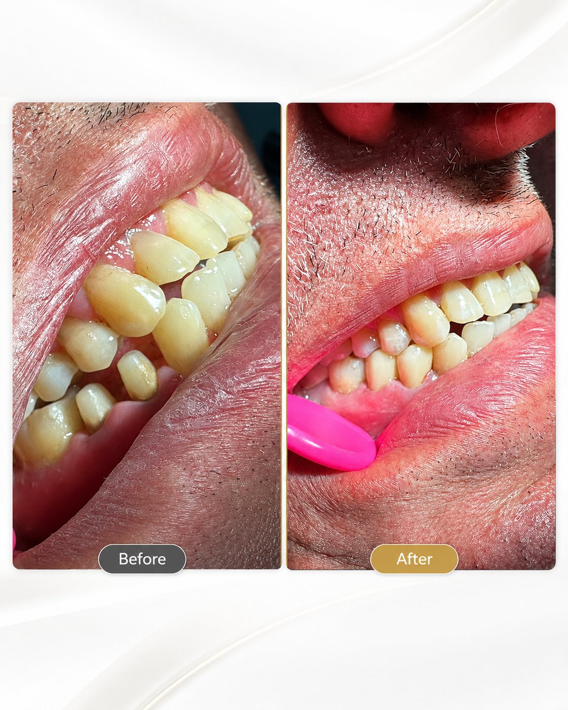 Clinical case — Dr. Yaseen Salah