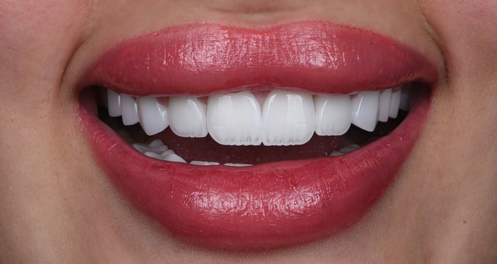 A finished smile