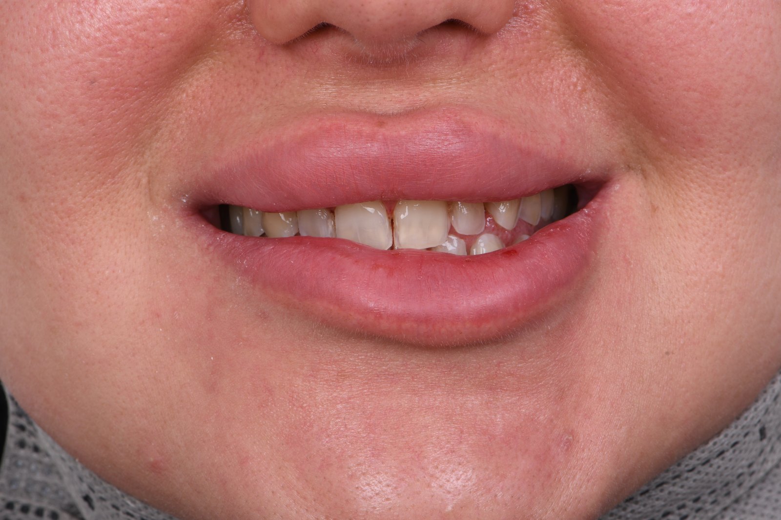 Before treatment — case 1